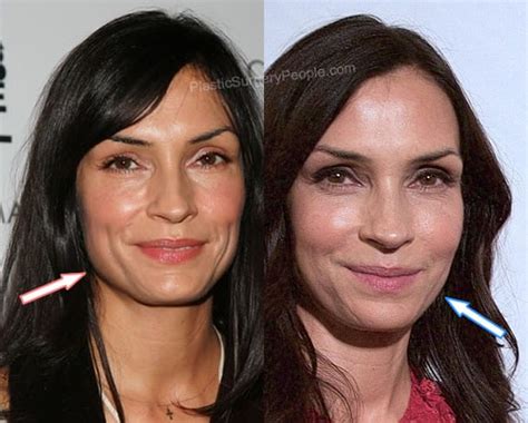 chanel janssen plastic surgery|famke janssen before and after 2022.